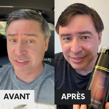 Box Anti-Cheveux Blancs – Édition Limitée